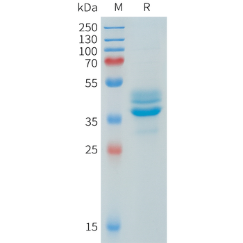 Mouse Mesothelin Protein, His Tag