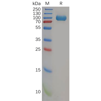 Human IFNAR1 Protein, hFc Tag