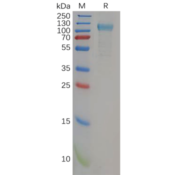 Human FGF21 Protein, hFc Tag
