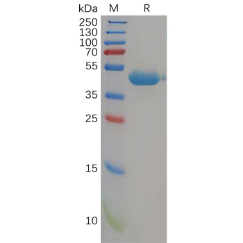Human B7-H7 Protein, hFc Tag