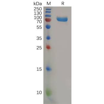 Human CD72 Protein, hFc Tag