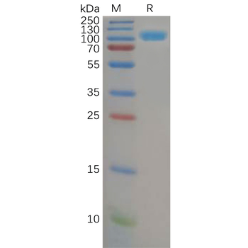 Human TIMP4 Protein, hFc Tag