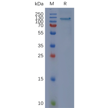 Human ANXA1 Protein, His Tag