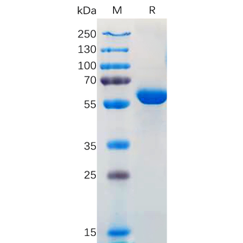 Human CD142 Protein, hFc Tag