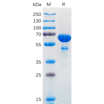 Human IL1R2 Protein, His Tag