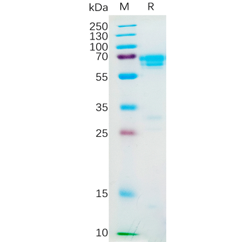 Human IFNAR1 Protein, mFc Tag
