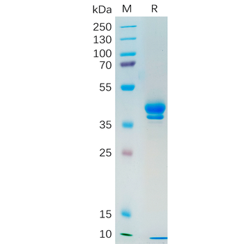 Human TMIGD2 Protein, hFc Tag