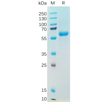 Human Mesothelin(37-286) Protein, His Tag
