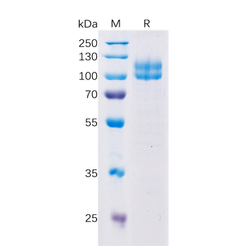 Human CD235A Protein, hFc Tag