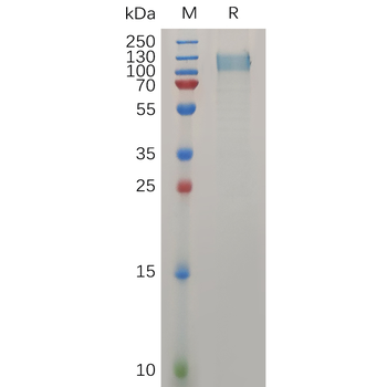 Human DLK1 Protein, hFc Tag