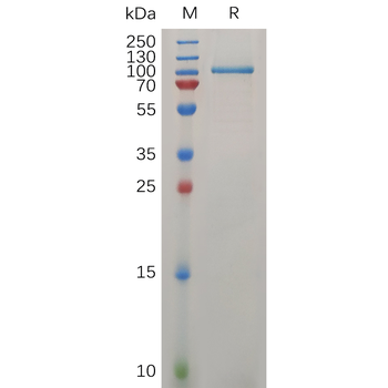 Human TGFA Protein, hFc Tag