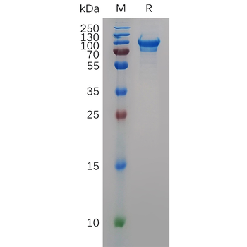 Human TYRO3 Protein, hFc Tag