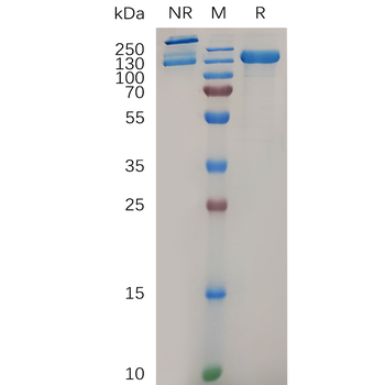 Human TGFB2(303-414) Protein, hFc Tag