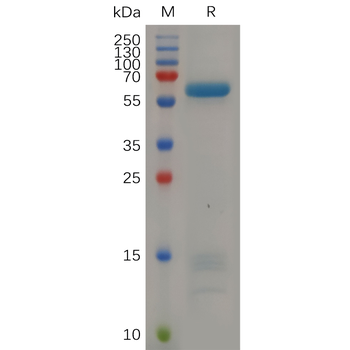 Human IFNAR2 Protein, hFc Tag
