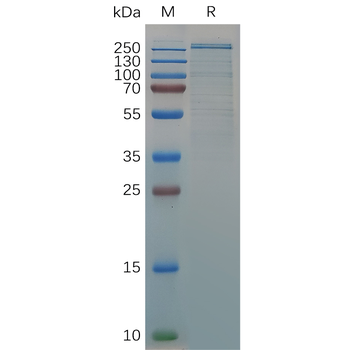 Human CXCL9 Protein, hFc Tag