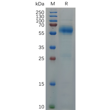 Human CXCL1 Protein, hFc Tag