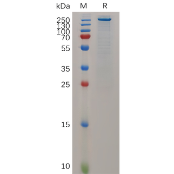 Human CCL2 Protein, hFc Tag