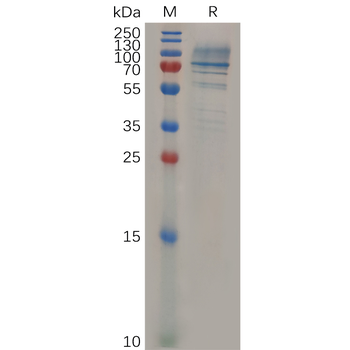 Human ANG1 Protein, hFc Tag
