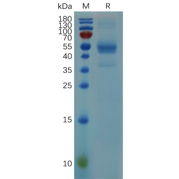 Human CD26 Protein, hFc Tag
