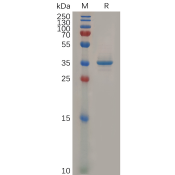 Human IL15 Protein, hFc Tag