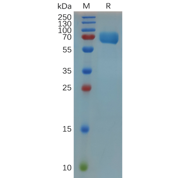 Human IL10R Protein, hFc Tag