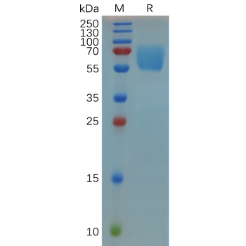 Human IL10 Protein, hFc Tag
