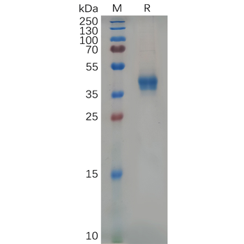 Human FCMR Protein, hFc Tag