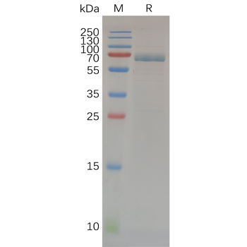 Human ITGAV & ITGB1 Heterodimer Protein, His Tag & hFc Tag