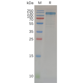 Human CD4 Protein, hFc Tag