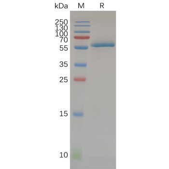 Human CD1A Protein, hFc Tag