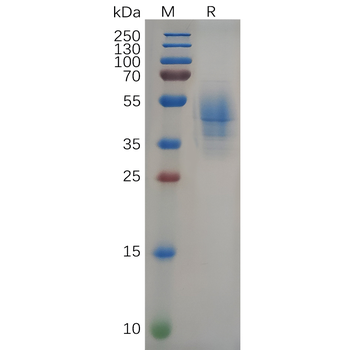 Human IL8 Protein, hFc Tag