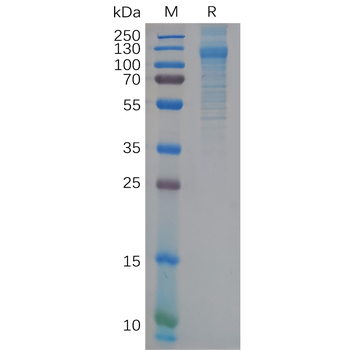 Human CD8A Protein, hFc Tag