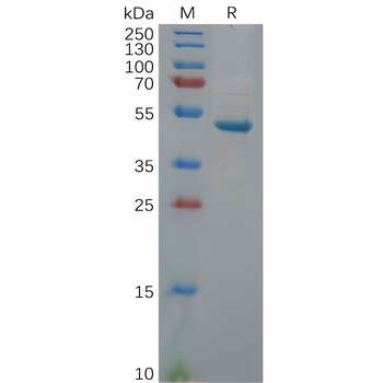 Human CD147 Protein, hFc Tag