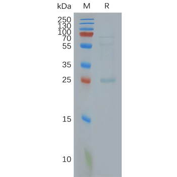 Human CLDN18.2 full length protein-synthetic nanodisc