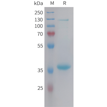 Cynomolgus BTN3A1 Protein, His Tag