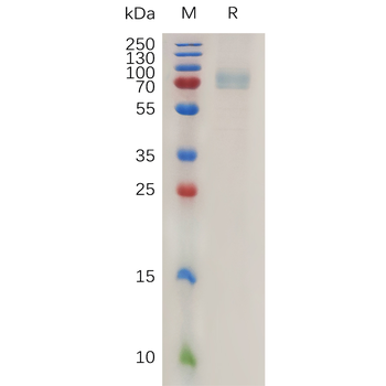 Human DLK1 Protein, His Tag
