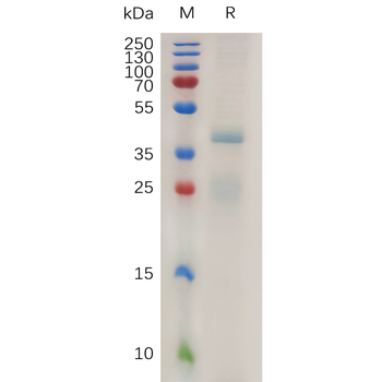 Human BCAM Protein, His Tag