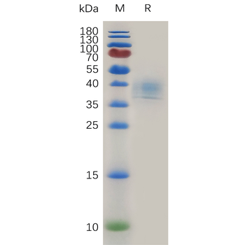 Human BTN3A2 Protein, His Tag