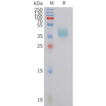 Human IL-15RAandIL-15 (C-Fc) Protein