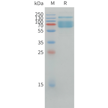 Human IL-3 (N-6His) Protein