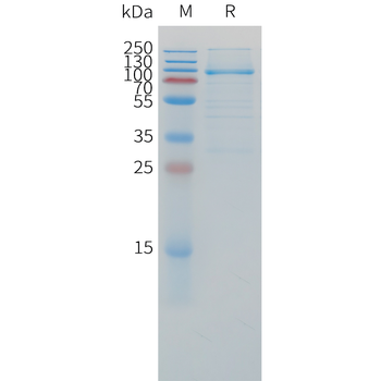 Human CCL8 (C-6His) Protein