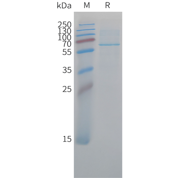 Human CCL17 (C-6His) Protein