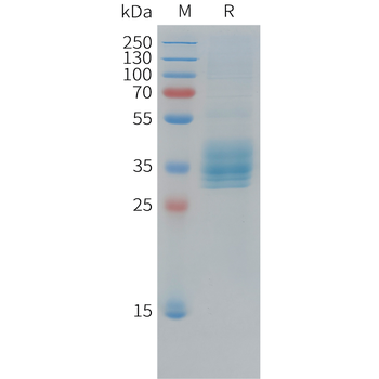 Human FGFb (Q65I,C96S,N111G) Protein