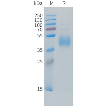 Human Beta-NGF (Mammalian) Protein