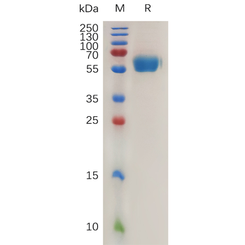 Human PDGFD(250-370) Protein, hFc Tag