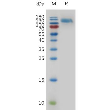 Human IL17F Protein, His Tag