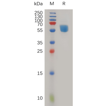 Monkeypox virus E8L Protein, His Tag