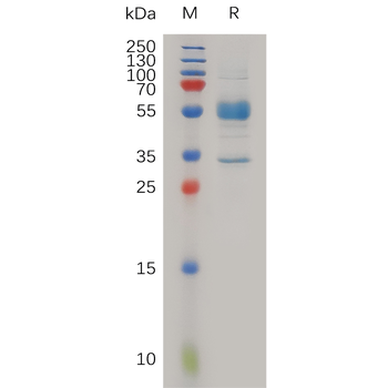 Human IL10 Protein, His Tag