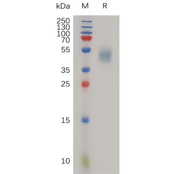 Human IL9 Protein, hFc Tag