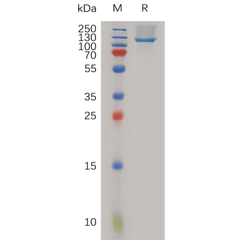 Human IL9 Protein, His Tag